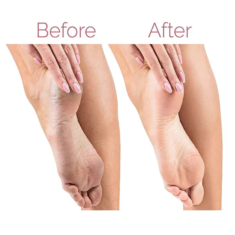 Electric Pedicure Foot File Callus Remover Adeeba's Collection